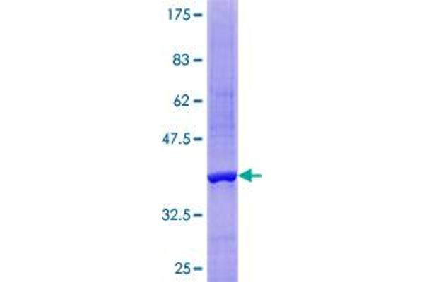 NT5C Protein (AA 1-117) (GST tag)