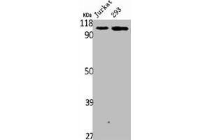 Western Blot analysis of Jurakt 293 cells using Plakophilin 2 Polyclonal Antibody (Plakophilin 2 antibody  (C-Term))