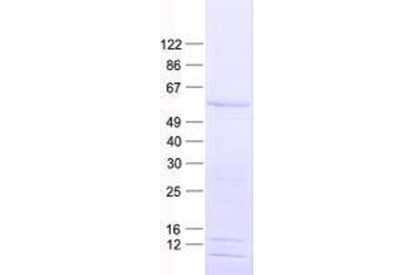VEZF1 Protein (His tag)