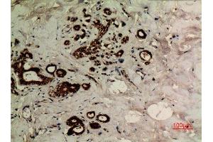 Immunohistochemistry (IHC) image for anti-alpha Tubulin (TUBA1) (acLys40) antibody (ABIN3181895)