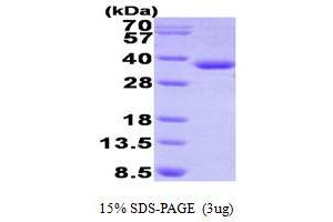 SDS-PAGE (SDS) image for Hydroxyacyl-CoA Dehydrogenase (HADH) (AA 13-314) protein (His tag) (ABIN666958)