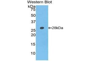 Detection of Recombinant AXIN, Rat using Polyclonal Antibody to Axis Inhibition Protein (AXIN) (Axin antibody  (AA 618-827))