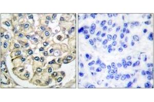 Immunohistochemistry (IHC) image for anti-Fibroblast Growth Factor Receptor 2 (FGFR2) (AA 471-520) antibody (ABIN1533272)