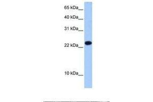 Image no. 1 for anti-Eukaryotic Translation Initiation Factor 4E Family Member 3 (EIF4E3) (C-Term) antibody (ABIN6739151) (EIF4E3 antibody  (C-Term))