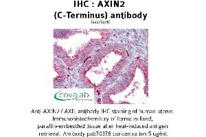Image no. 2 for anti-Axin 2 (AXIN2) antibody (ABIN1732157) (AXIN2 antibody)