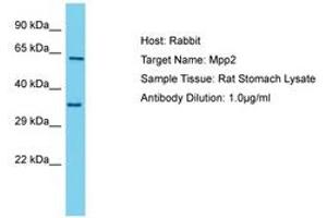 Image no. 1 for anti-Membrane Protein, Palmitoylated 2 (MAGUK P55 Subfamily Member 2) (MPP2) (C-Term) antibody (ABIN6750363) (MPP2 antibody  (C-Term))