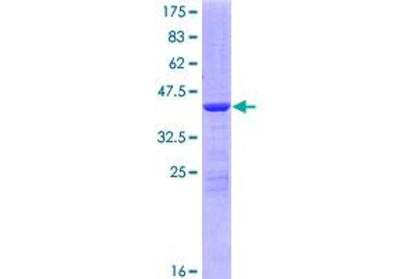 LSM4 Protein (AA 1-139) (GST tag)