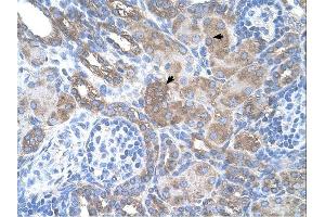SILV antibody was used for immunohistochemistry at a concentration of 4-8 ug/ml. (Melanoma gp100 antibody)