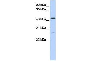 ACBD5 antibody used at 1 ug/ml to detect target protein. (ACBD5 antibody  (C-Term))