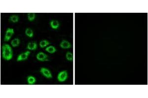 Immunofluorescence analysis of A549 cells, using ATP5D Antibody.