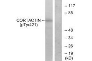 Western blot analysis of extracts from HeLa cells treated with H2O2, using Cortactin (Phospho-Tyr421) Antibody. (Cortactin antibody  (pTyr421))