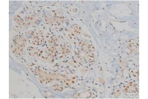 ABIN6267060 at 1/200 staining Human heart tissue sections by IHC-P. (ERK1 antibody  (pThr202, pTyr204))