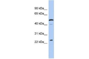 WB Suggested Anti-C1orf190 Antibody Titration: 0. (Chromosome 1 Open Reading Frame 190 (C1orf190) (Middle Region) antibody)