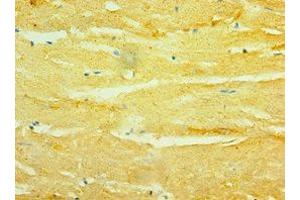 Immunohistochemistry of paraffin-embedded human heart tissue using ABIN7154912 at dilution of 1:100 (HSPB2 antibody  (AA 1-182))