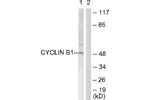 Western blot analysis of extracts from HeLa cells, treated with serum (10%, 15min), using Cyclin B1 (Ab-126) antibody (#BOO68, Line 1 and 2). (Cyclin B1 antibody  (Ser126))