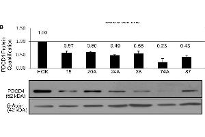 Western Blotting (WB) image for anti-Programmed Cell Death 4 (PDCD4) (pSer457) antibody (ABIN129708)
