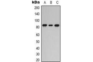 Western blot analysis of PKC epsilon expression in HEK293T (A), Hela (B), HepG2 (C) whole cell lysates. (PKC epsilon antibody  (C-Term))