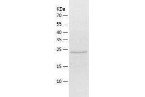 Western Blotting (WB) image for Ubiquitin-Conjugating Enzyme E2E 3 (UBE2E3) (AA 1-207) protein (His tag) (ABIN7288248) (UBE2E3 Protein (AA 1-207) (His tag))