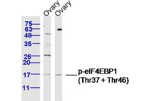 eIF4EBP1 Antikörper  (pThr37, pThr46)