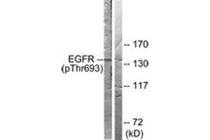 Western blot analysis of extracts from A431 cells, using EGFR (Phospho-Thr693) Antibody.