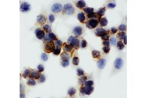 Anti-Annexin V antibody, ICC ICC: HCT116 Cell (Annexin V antibody  (Middle Region))