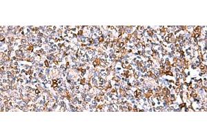Immunohistochemistry of paraffin-embedded Human tonsil tissue using IP6K1 Polyclonal Antibody at dilution of 1:40(x200) (IP6K1 antibody)