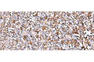 Immunohistochemistry of paraffin-embedded Human tonsil tissue using IP6K1 Polyclonal Antibody at dilution of 1:40(x200)