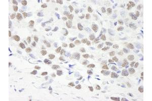 anti-Symplekin (SYMPK) (AA 1224-1274) antibody