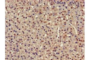 IHC image of ABIN7142234 diluted at 1:500 and staining in paraffin-embedded human adrenal gland tissue performed on a Leica BondTM system.