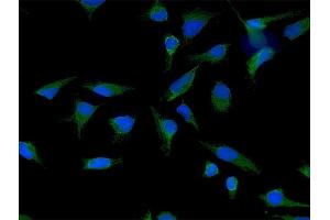 Immunofluorescence of purified MaxPab antibody to LETM1 on HeLa cell.