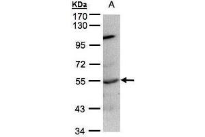 WB Image Sample(30 ug whole cell lysate) A:Raji , 7. (PTPN1 antibody)