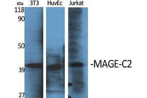 Western Blot (WB) analysis of specific cells using MAGE-C2 Polyclonal Antibody. (MAGEC2 antibody  (Internal Region))