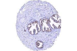Normal prostate with strong granular perinuclear cytoplasmic prostein staining of luminal cells (Recombinant SLC45A3 antibody  (N-Term))