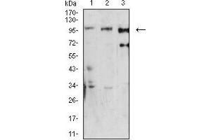 Western blot analysis using Dynamin-2 mouse mAb against U251 (1), Hela (2), and K562 (3) cell lysate. (DNM2 antibody  (AA 520-744))