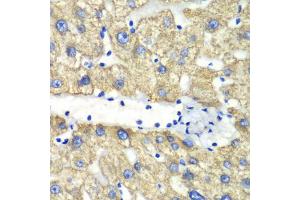 Immunohistochemistry of paraffin-embedded human liver injury using ABAT antibody (ABIN1876487) at dilution of 1:100 (40x lens). (ABAT antibody)