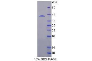SDS-PAGE analysis of Human SH3BP2 Protein.