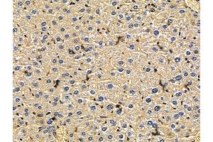 anti-Usher Syndrome 2A (Autosomal Recessive, Mild) (USH2A) antibody