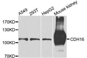 Western blot analysis of extracts of various cell lines, using CDH16 antibody. (Cadherin-16 antibody  (AA 19-230))