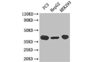 Western Blot Positive WB detected in: PC-3 whole cell lysate, HepG2 whole cell lysate, HEK293 whole cell lysate All lanes: C5AR1 antibody at 3 μg/mL Secondary Goat polyclonal to rabbit IgG at 1/50000 dilution Predicted band size: 40 kDa Observed band size: 40 kDa (C5AR1 antibody  (AA 1-36))