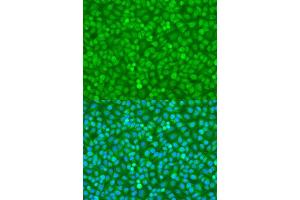 Immunofluorescence analysis of U2OS cells using FOXO3 antibody. (FOXO3 antibody  (AA 394-672))