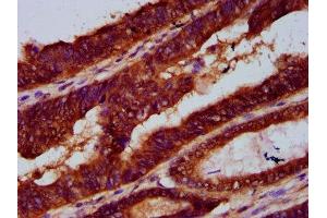 LARP7 antibody  (AA 409-471)