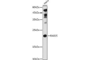 Western blot analysis of extracts of HeLa cells, using R antibody (ABIN6133143, ABIN6146576, ABIN6146578 and ABIN6224057) at 1:1000 dilution. (RAB35 antibody  (AA 1-201))