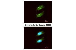 ICC/IF Image Immunofluorescence analysis of methanol-fixed HeLa, using PKA alpha, antibody at 1:200 dilution. (PRKACA antibody  (Center))