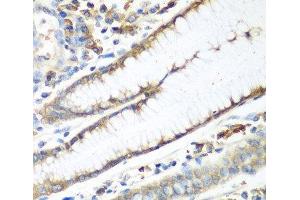 Immunohistochemistry (Paraffin-embedded Sections) (IHC (p)) image for anti-Carbamoyl-Phosphate Synthetase 2, Aspartate Transcarbamylase, and Dihydroorotase (CAD) antibody (ABIN7264367)