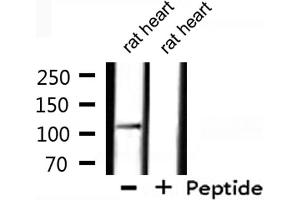 Western blot analysis of extracts from rat heart, using XPF Antibody.