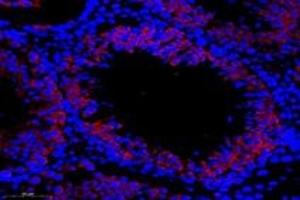 Immunofluorescent analysis of paraformaldehyde-fixed rat testis using,TTC12 (ABIN7075869) at dilution of 1: 1000 (TTC12 antibody)