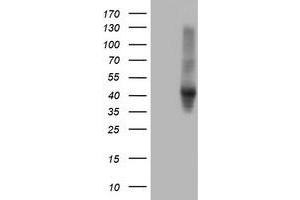 HEK293T cells were transfected with the pCMV6-ENTRY control (Left lane) or pCMV6-ENTRY SERPINE2 (Right lane) cDNA for 48 hrs and lysed. (SERPINE2 antibody)