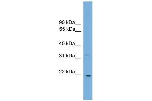 WB Suggested Anti-CTF1  Antibody Titration: 0. (Cardiotrophin 1 antibody  (N-Term))