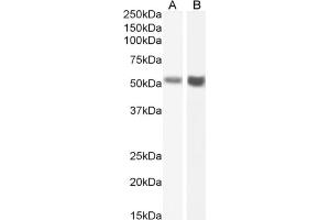 Western Blot using anti-Fas antibody R-125224. (Recombinant FAS antibody)