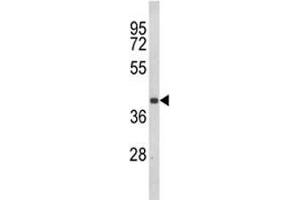 Western blot analysis of CCR3 antibody and Jurkat lysate. (CCR3 antibody  (AA 291-318))